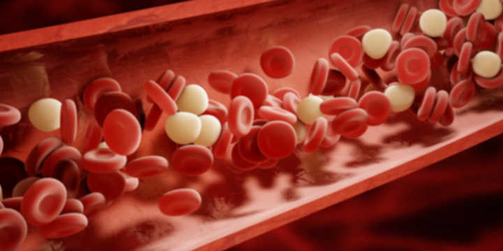 Placche di colesterolo nel sangue