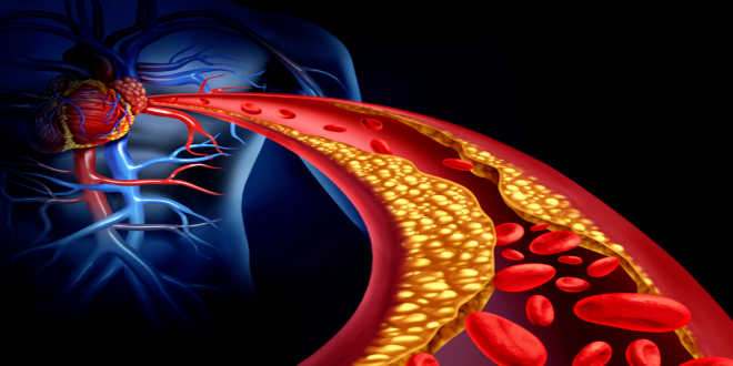 Olio di krill contro il colesterolo