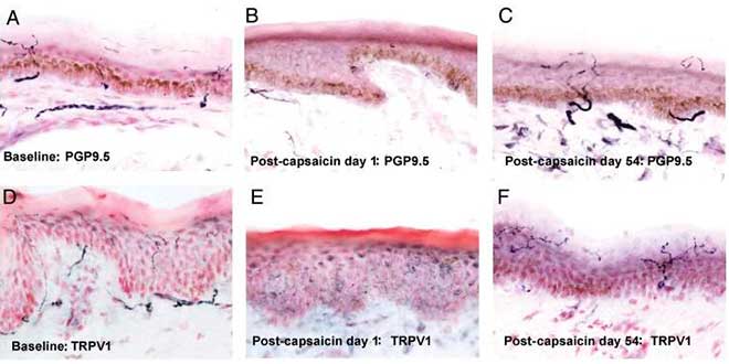 Effetti della capsaicina nel corpo