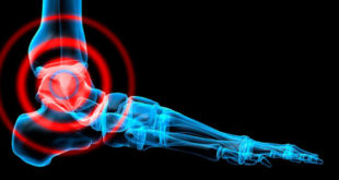 Esercizi per riprendersi da infortuni alle caviglie