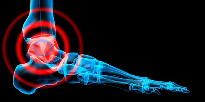 Esercizi di rinforzamento della caviglia