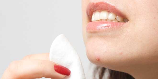 Aglio per combattere l'acne Aglio per combattere l'acne