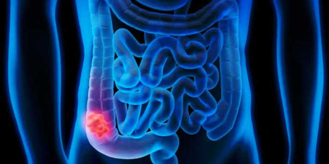 Flora intestinale e disbiosi Flora intestinale e disbiosi