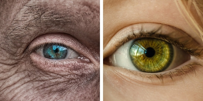 Effetti dei radicali liberi Effetti dei radicali liberi