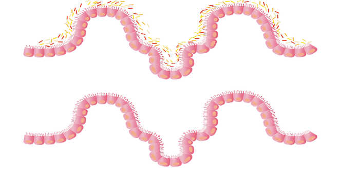 Flora intestinale ricca