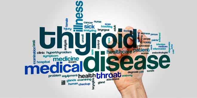 Sintomi dell'ipertiroidismo