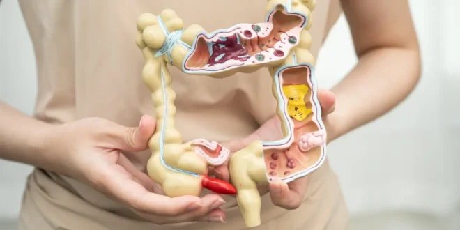 Come si distrugge la flora intestinale? Come si distrugge la flora intestinale?