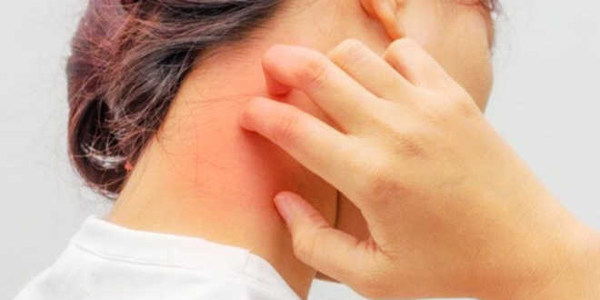 Acido caprilico e candida Acido caprilico e candida