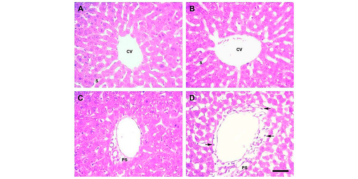 lobulo epatico lobulo epatico