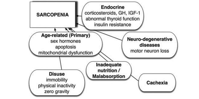 Fisiopatogenesi della sarcopenia Fisiopatogenesi della sarcopenia