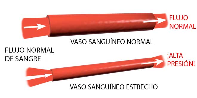 Vasi Sanguigni Vasi Sanguigni