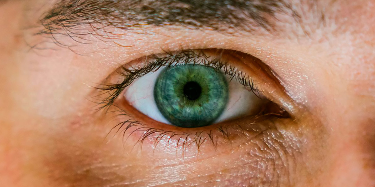 Cosa sono le occhiaie