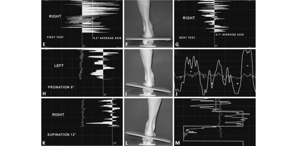 Piattaforma di pressione Piattaforma di pressione