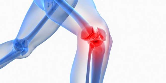SAMe e osteoartrite SAMe e osteoartrite