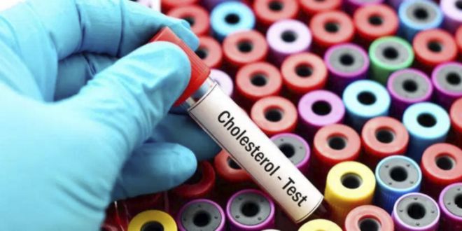 Test per il Colesterolo