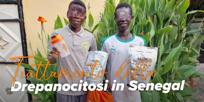 HSN collabora per trattare la Drepanocitosi in Senegal HSN collabora per trattare la Drepanocitosi in Senegal