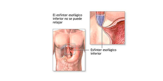 sfintere sfintere
