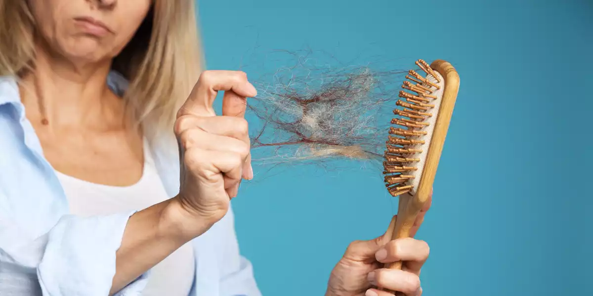 Alopecia nelle donne