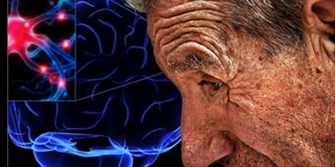 Esercizio fisico specifico per il Parkinson