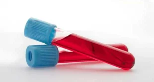 Parametri strani nelle analisi quando si usano steroidi